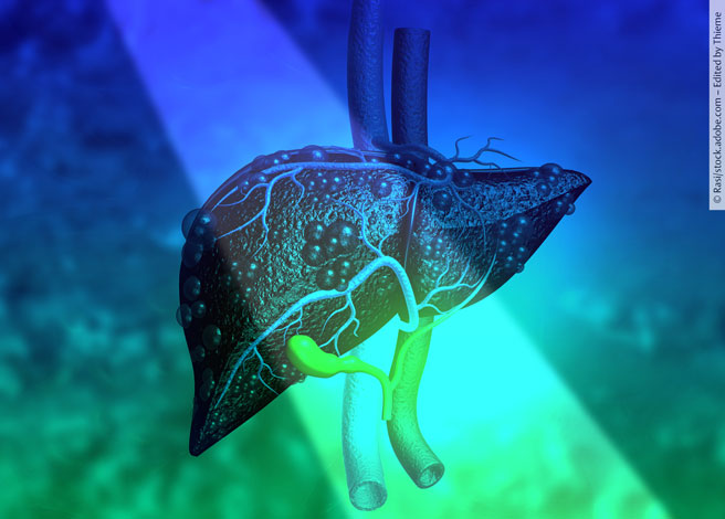 4zevar/stock.adobe.com