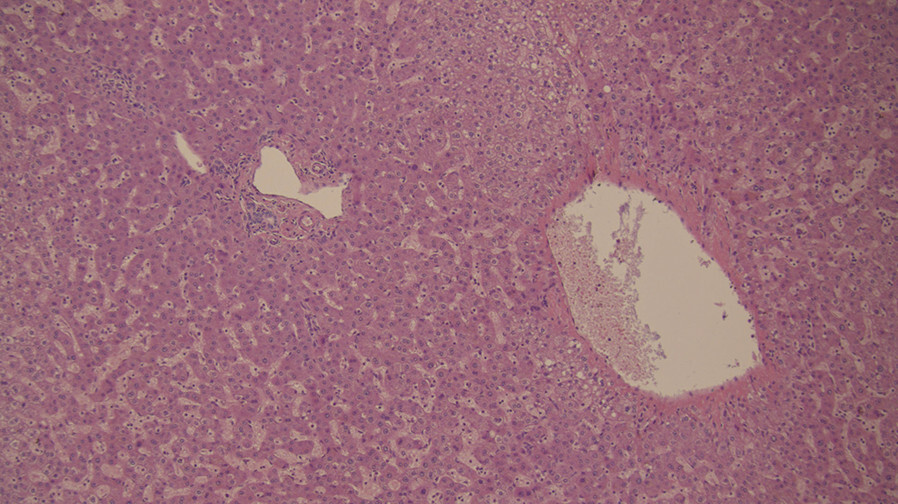 Abb.5.25a-Spektrum-der-MASLD