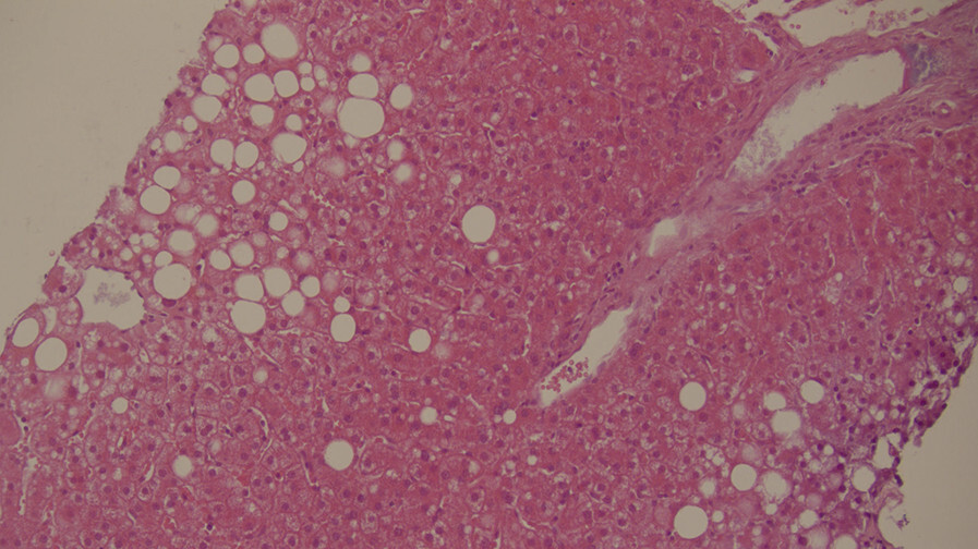 Abb.5.25b-Spektrum-der-MASLD