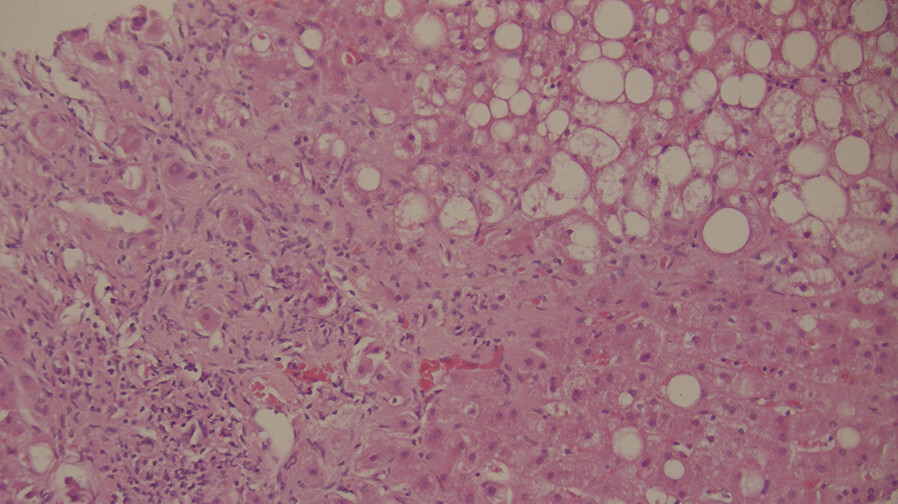 Abb.5.25c-Spektrum-der-MASLD