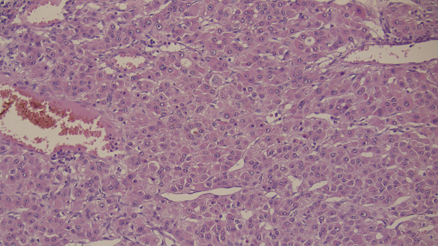 Abb.5.25d-Spektrum-der-MASLD